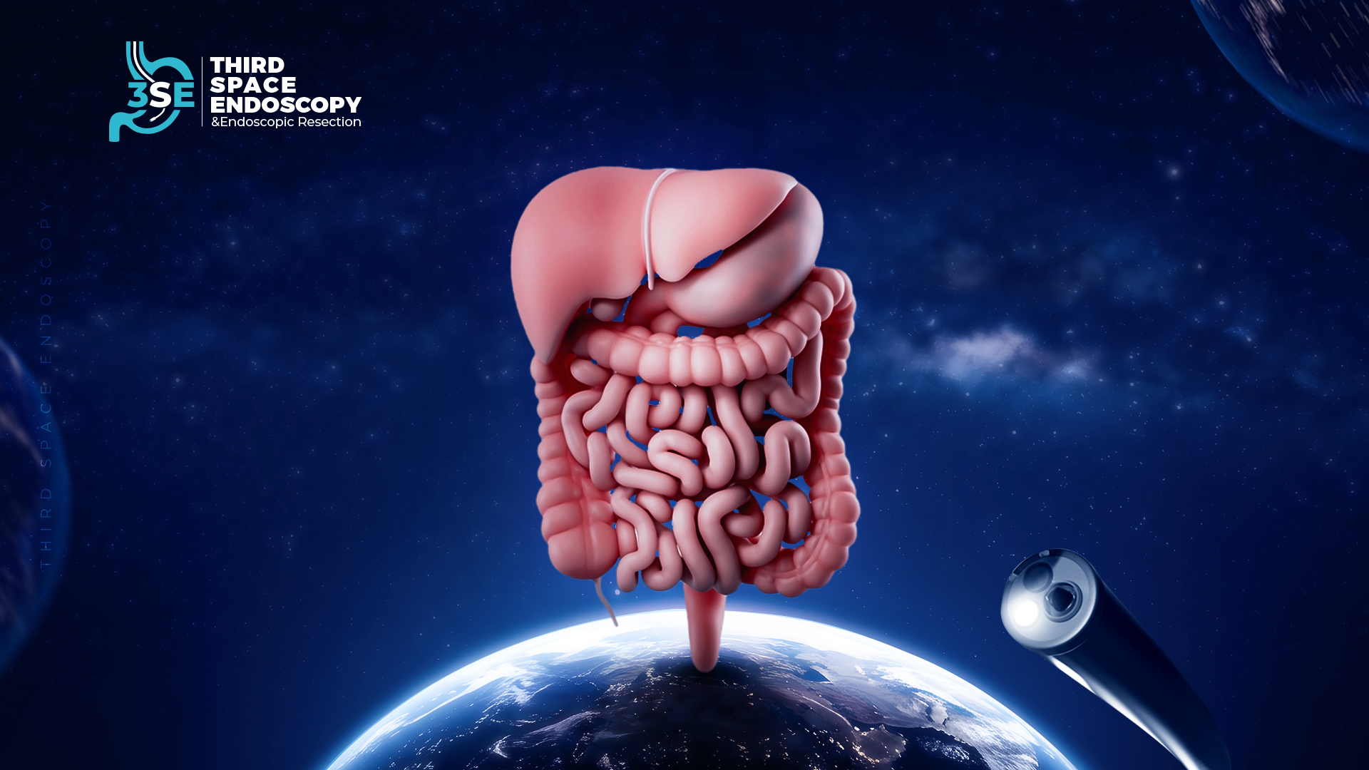 3rd Space Endoscopy